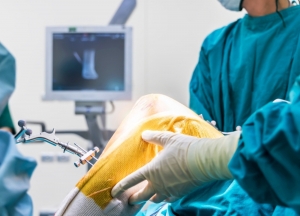 Revolutionizing Orthopaedic Surgery in Australia: Robotic Knee Replacement in Brisbane